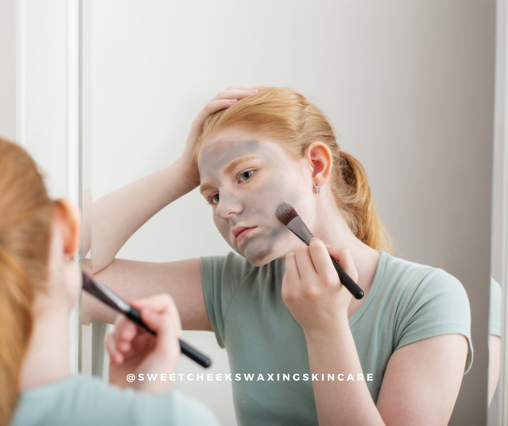 Breakouts & You: A Teen’s Guide to Acne with Empowered Self-Care